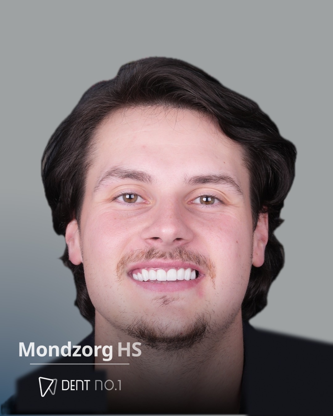 Mondzorg HS hasta deneyimi 1